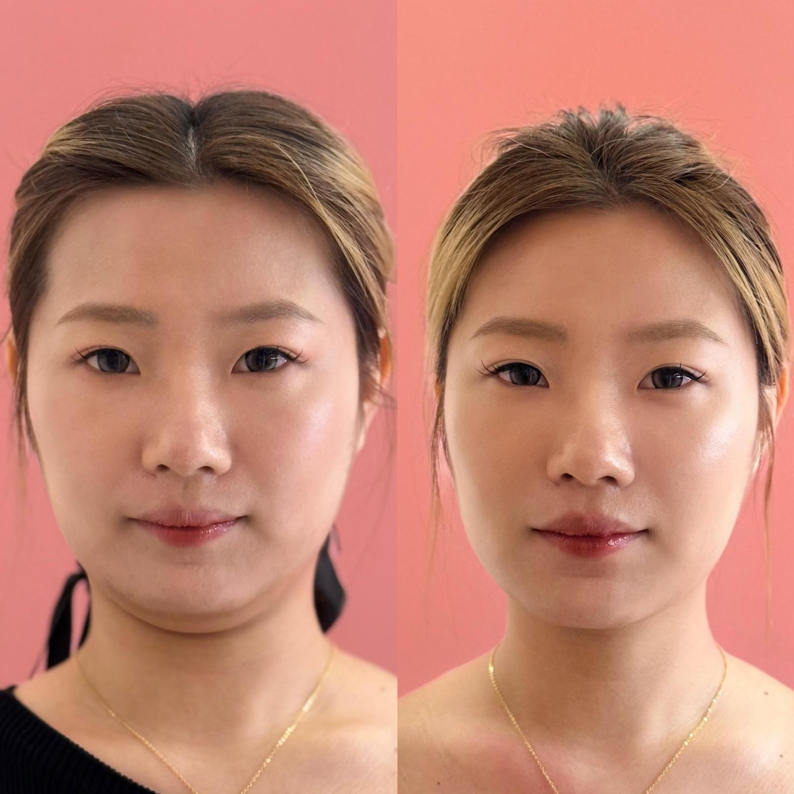 AxoAesty Ultra Firming Essence - Image 2